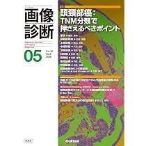 71uYf4NwhPL._AC_UL210_SR210,