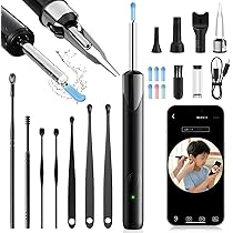 Amazon | 耳かき カメラ付き 【2026年プレミアム新登場・2200W超高画素