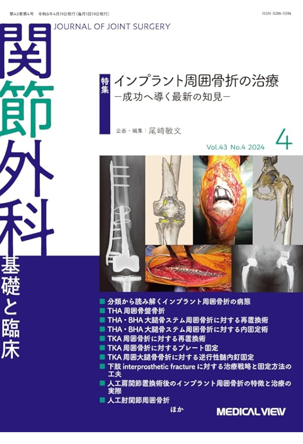 Amazon.co.jp: インプラント周囲骨折を極める : 馬場智規: Japanese Books