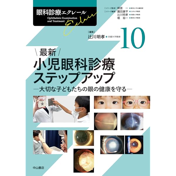最新 弱視・斜視診療エキスパートガイドー解剖生理・検査法から手術