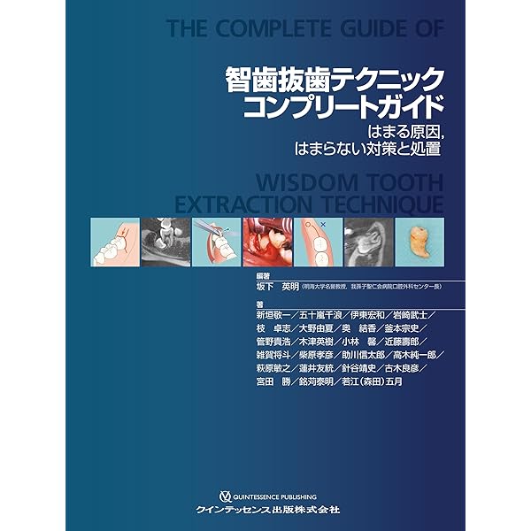 完全解説 根管治療トラブル攻略本: エンドのよくある24の難局面大攻略