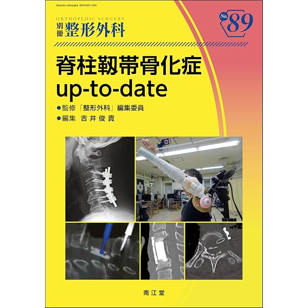 裁断済　脊柱変形 up-to-date 脊柱変形 up-to-date (別冊整形外科 No.87) | 竹下克志 |本 | 通販