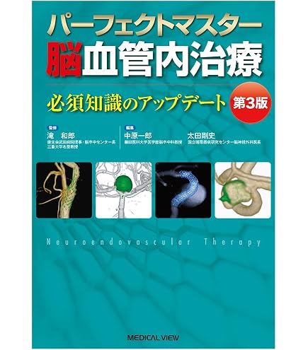 Amazon.co.jp: 脳血管模型：教育用（オリジナルプロダクト） : 産業
