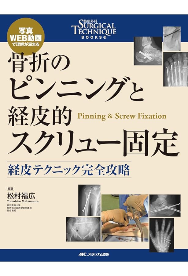 手の構造 Structures of the Hand | 玉井 誠 |本 | 通販 | Amazon