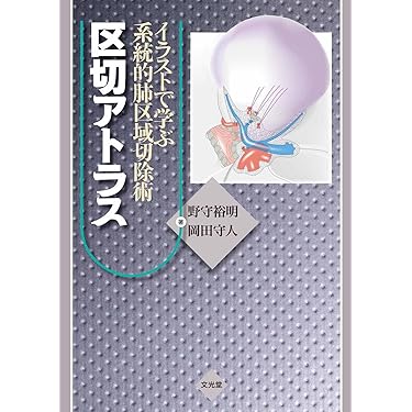 イラストで学ぶ系統的肺区域切除術 区切アトラス - 野守裕明、岡田守人著 71zfPzMrRFL._AC_UL375_SR375,
