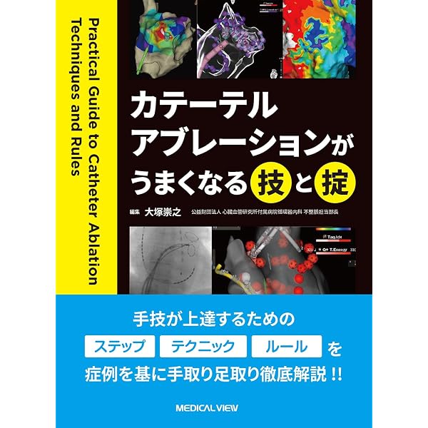 Amazon.co.jp: EPSとSVT―心臓電気生理学的検査と上室頻拍 : 永嶋孝一