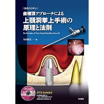 基礎から学ぶ 歯槽頂アプローチによる上顎洞挙上手術の原理と法則 