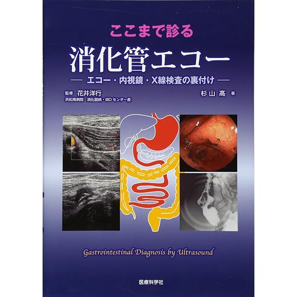 新超音波検査 消化管 | 関根 智紀 |本 | 通販 | Amazon