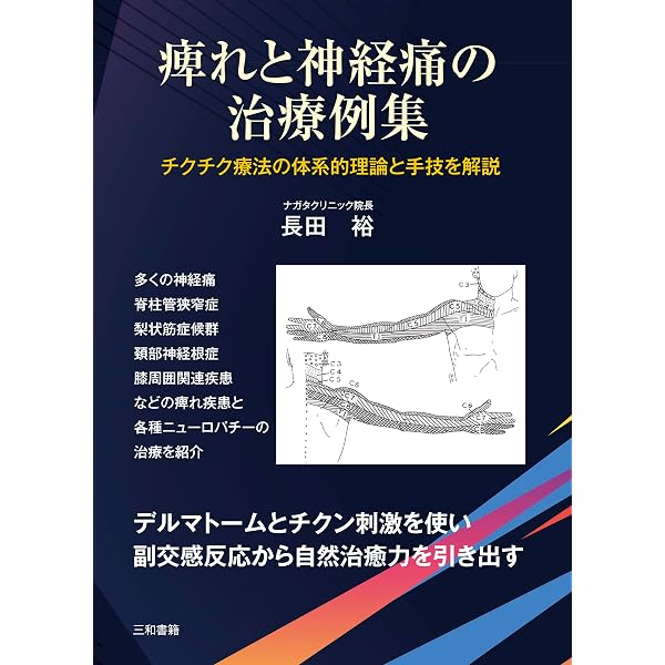 Amazon.co.jp: 無血刺絡の臨床: 痛圧刺激法による新しい臨床治療