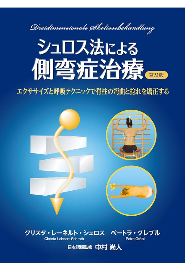 Amazon.co.jp: 小児脊柱変形治療の最前線 : 日本側彎症学会: 本