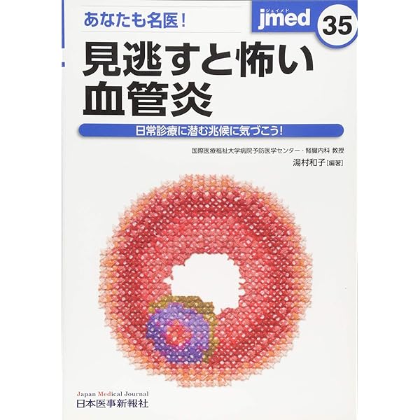 Amazon.co.jp: 皮膚血管炎 第2版 : 川名 誠司, 陳 科榮: 本