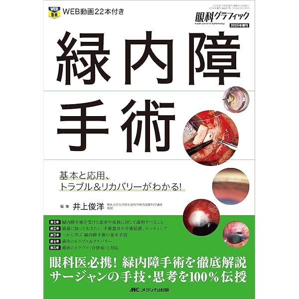 Amazon.co.jp: 網膜硝子体手術：基本と応用，トラブル＆リカバリーが
