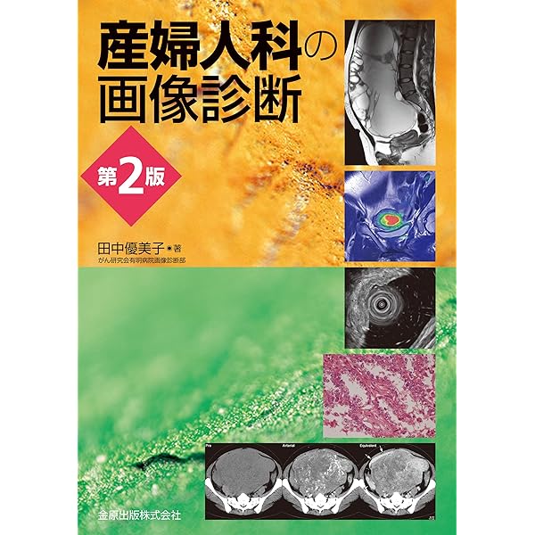 神経内科疾患の画像診断 第2版 神経内科疾患の画像診断 第2版 | 柳下 章 |本 | 通販 | Amazon