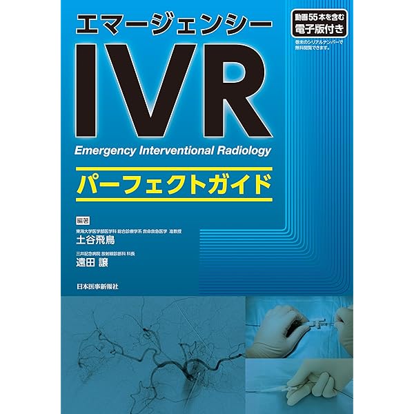 Amazon.co.jp: 肝動脈化学塞栓療法(TACE): 理論と実践ストラテジー
