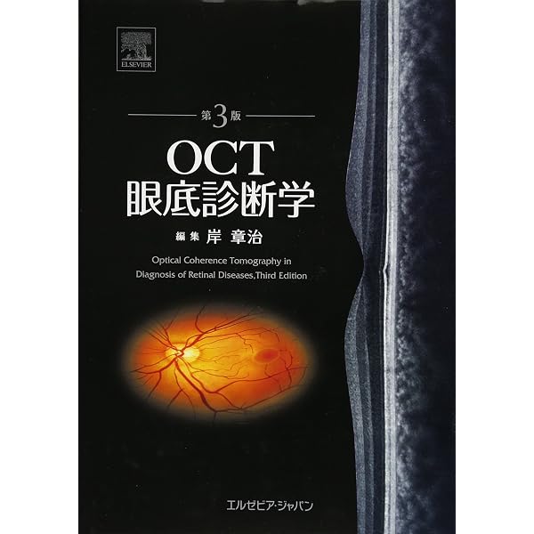 【値引交渉可】(サイン付き)OCT眼底診断学 第2版 Amazon.co.jp: OCT眼底診断学 第2版 : 岸 章治, 岸 章治: 本