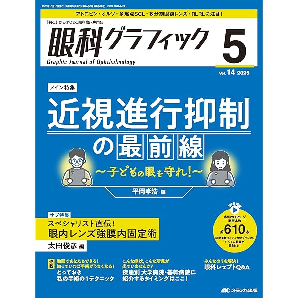 小児の近視 ─ 診断と治療 第2版 | 日本近視学会, 日本小児眼科学会