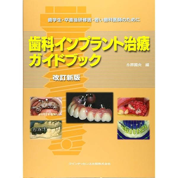 歯科インプラント治療ガイドブック ―卒直後研修医・若い歯科医師のため
