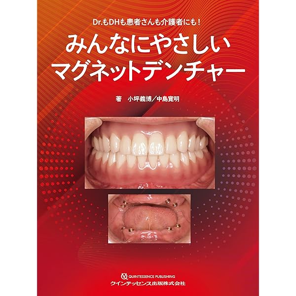 GDS 総義歯の真髄 | 松本 勝利 |本 | 通販 | Amazon