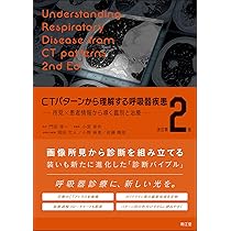 CTパターンから理解する呼吸器疾患 所見×患者情報から導く鑑別と治療 CTパターンから理解する呼吸器疾患(改訂第2版): 所見×患者情報から導く