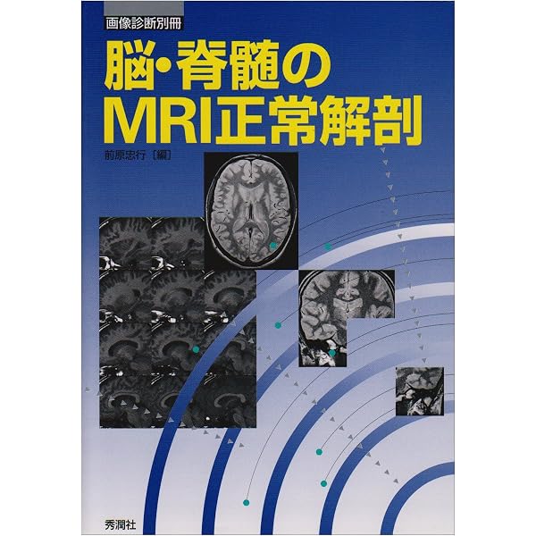 脳MRI 1.正常解剖 | 高橋 昭喜, 高橋 昭喜 |本 | 通販 | Amazon