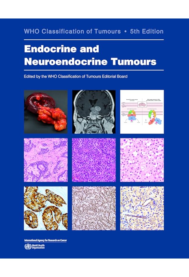 Amazon | Haematolymphoid Tumours: Who Classification of Tumours