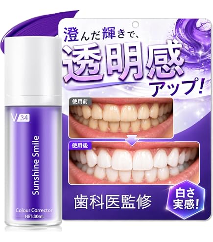 Amazon | IZUMIKEN ホワイトニングLEDライト マウスピース 本体+ジェル