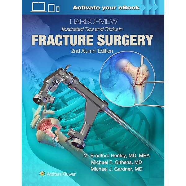 Amazon | Rockwood and Wilkins' Fractures in Children: Print +