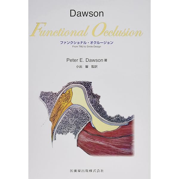 DawsonFunctional Occlusionファンクショナル・オクルージョン