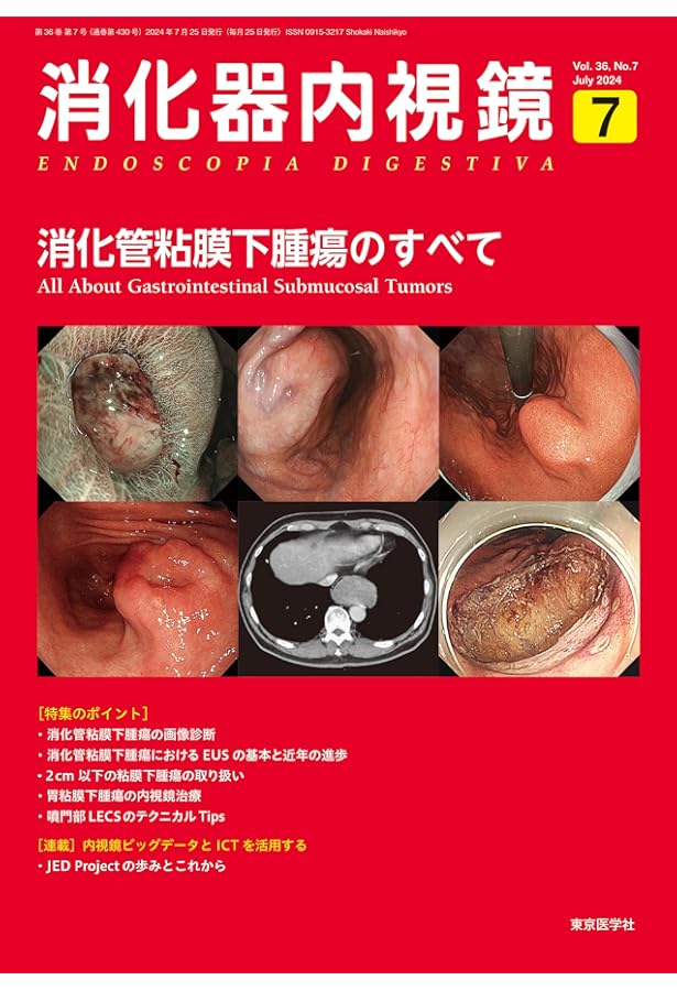 消化管EUSパーフェクトガイド　裁断済み 511LW3eOkFL._AC_SY200_QL15_.jpg