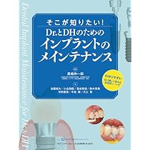 基本から学び直すインプラント補綴: 今さら聞けない・でも知りたい