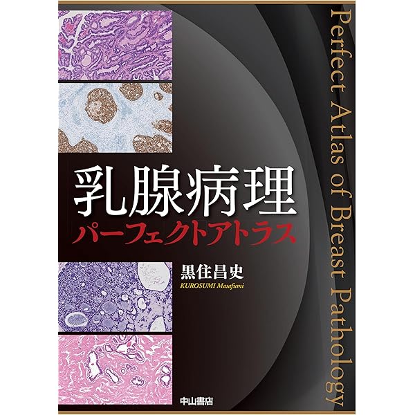 乳癌第3版　腫瘍病理鑑別診断アトラス 乳癌 第3版(腫瘍病理鑑別診断アトラス) | 森谷卓也, 津田 均