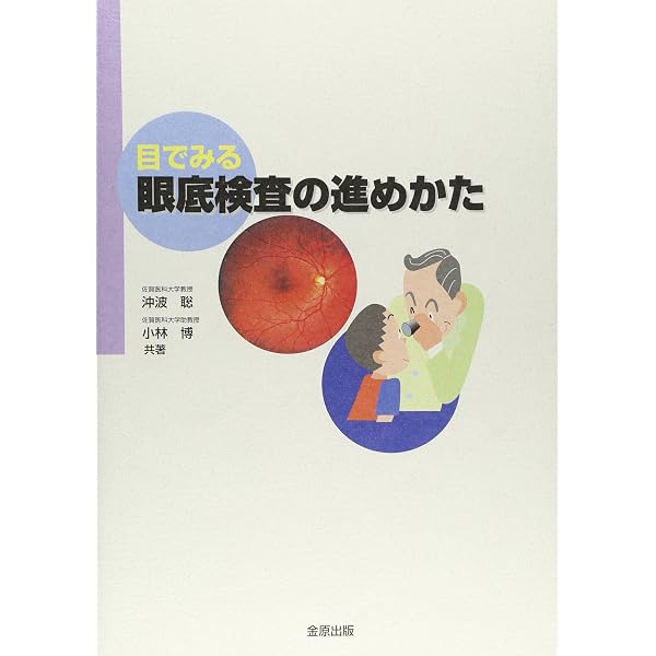 健診のための眼底検査 改訂版〜無散瞳カメラによる撮影と判定〜 (手に