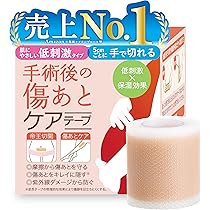 傷あと治療　裁断なし Amazon.co.jp: アトファイン傷あとケアテープ Mサイズ 手術後の傷あと