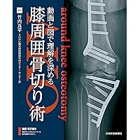 Knee Osteotomy アップデート Knee Osteotomy アップデート ゼロから