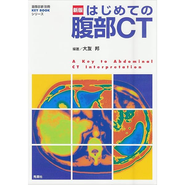 ♢裁断済 胸部の画像診断 即戦力が身につく胸部の画像診断 | 芦澤和人, 藤本公則, 藪内英