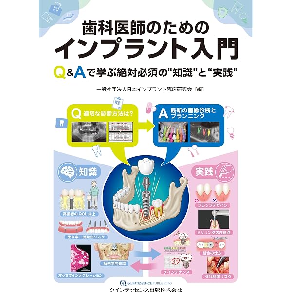 OJのスペシャリストたちがおくる インプラント 基本の「き」 (別冊QDI