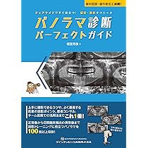 パノラマ診断パーフェクトガイド　歯科医師　歯科衛生士 パノラマ診断 パーフェクトガイド: チェアサイドですぐ役立つ! 撮影