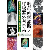 胸部画像診断と呼吸器外科手術 | 近藤晴彦, 遠藤正浩 |本 | 通販 | Amazon