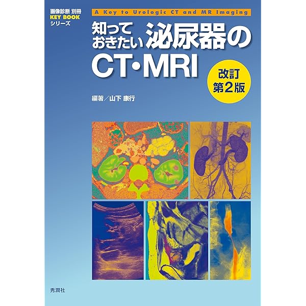 円高還元 すぐ役立つ救急のCT・MRI 改訂第2版 BOOK (画像診断別冊KEY 