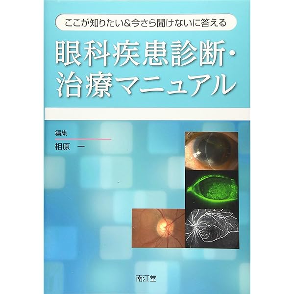 眼科診療ガイド 第2版 | 根木 昭 |本 | 通販 | Amazon