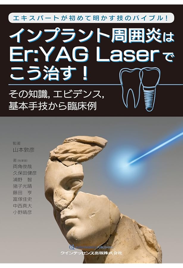 Amazon.co.jp: 歯周治療 ・ インプラント周囲治療のための Er