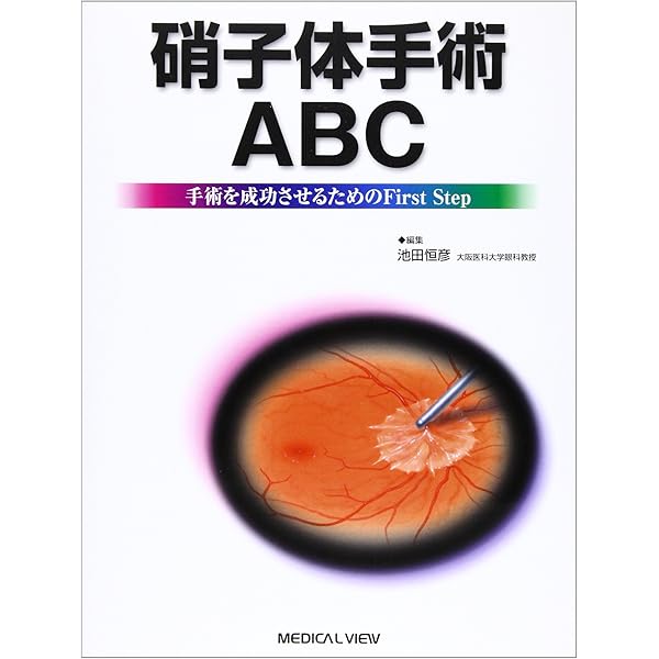 小切開硝子体手術 入門!−これだけわかれば始められる | 米田 一仁 |本