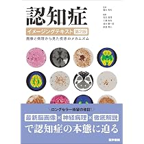 Amazon.co.jp: 認知症イメージングテキスト 第2版: 画像と病理から見た