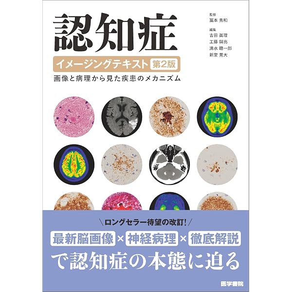 認知症イメージングテキスト 画像と病理から見た疾患のメカニズム Amazon.co.jp: 認知症イメージングテキスト 第2版: 画像と病理から見た