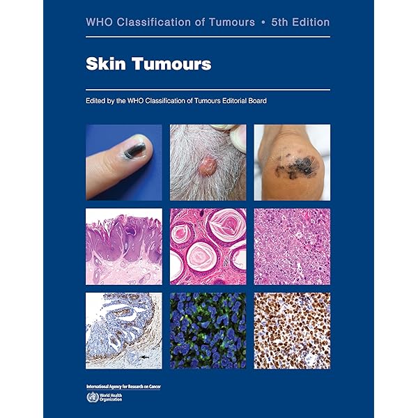 Amazon | Head and Neck Tumours (WHO Classification of Tumours