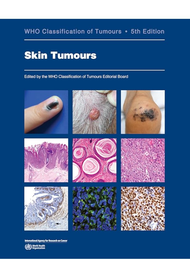 Amazon | Haematolymphoid Tumours: Who Classification of Tumours