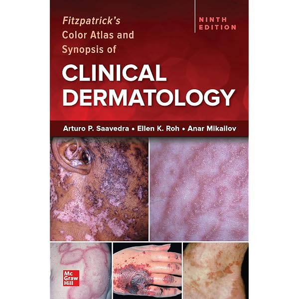 Lookingbill and Marks' Principles of Dermatology - E-Book eBook