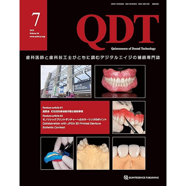 QDT 2025年6月号: 歯科医師と歯科技工士がともに読むデジタル