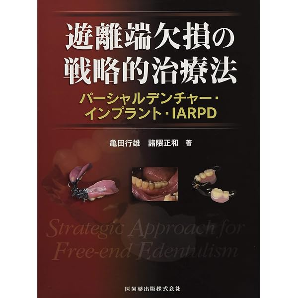 Amazon.co.jp: インプラントパーシャルデンチャーIARPDの臨床 : 亀田