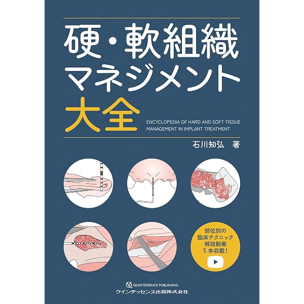 ゼロボーンロスコンセプト - クインテッセンス出版 - 健康・医学 ゼロボーンロスコンセプト